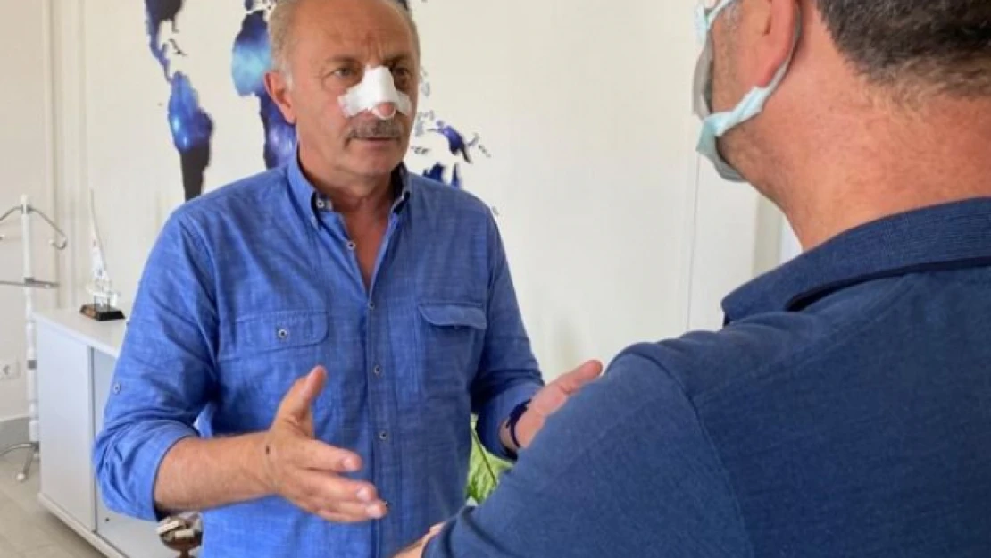 Deniz Atabay'ın burnu kırılmış