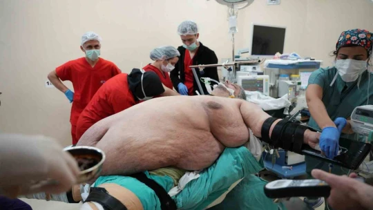 Hastaneye sedye ile gelen 310 kiloluk Aydınlı adam yürüyerek taburcu oldu