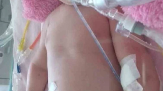 Özel hastanede oksijensiz kaldığı iddiasıyla serebral palsi tanısı konan kızları için 'adalet' arıyorlar