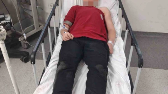 Sınıf arkadaşlarını özür dileme bahanesi ile çağırıp darp ettiler