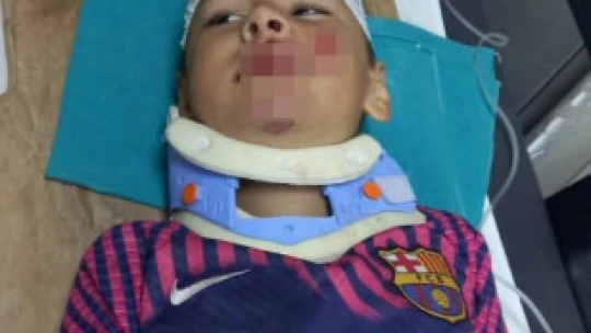 Söke'de üzerine okulun demir kapısı düşen çocuğun kafasına 12 dikiş atıldı